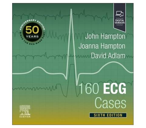 160 ECG Cases Hampton John