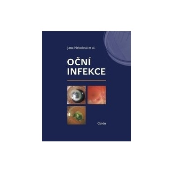 Oční infekce