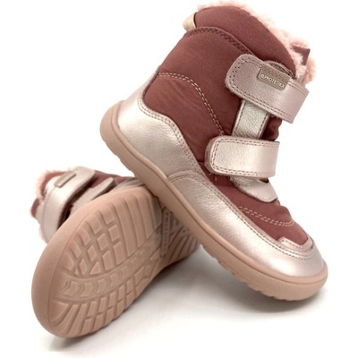 Protetika s membránou nut pink