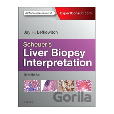 Scheuers Liver Biopsy Interpretation, 9. vydanie