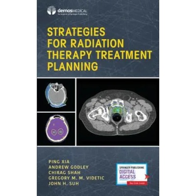 Strategies for Radiation Therapy Treatment Planning | Ping Xia, Andrew Godley, Chirag Shah, John Suh