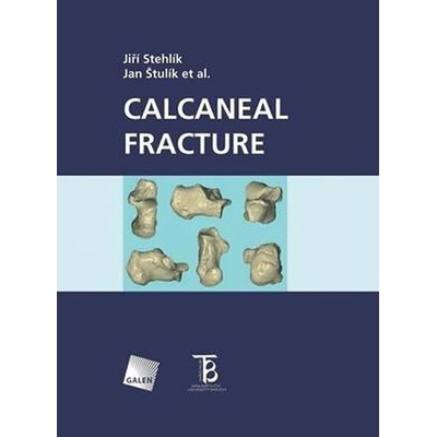 Calcaneal fracture - Jiří Stehlík, Jan Štulík