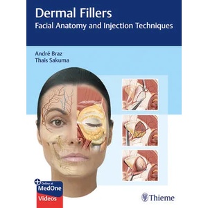 Dermal Fillers | André Vieira Braz, Thais Harumi Sakuma (ISBN: 9783132427723)