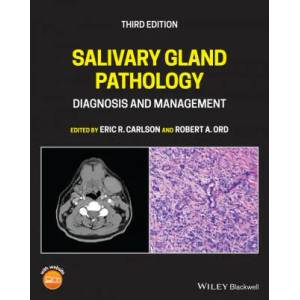 Salivary Gland Pathology - Diagnosis and Management Third Edition | ER Carlson (ISBN: 9781119730187)