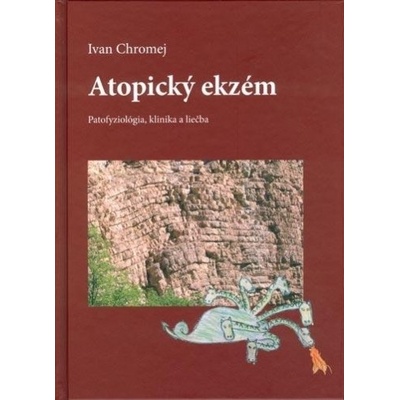 Atopický ekzém - Ivan Chromej