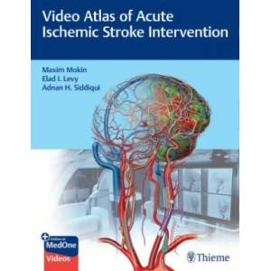 Video Atlas of Acute Ischemic Stroke Intervention | Elad Levy, Adnan Siddiqui (ISBN: 9781684202492)