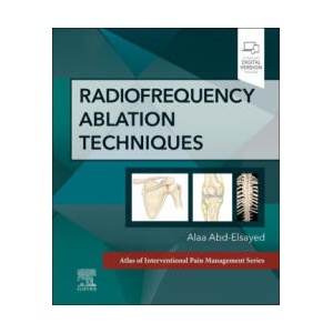 Radiofrequency Ablation Techniques | Alaa Abd-Elsayed (2023)