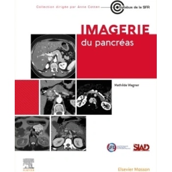 Imagerie du pancréas | Docteur Mathilde Wagner