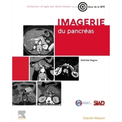Imagerie du pancréas | Docteur Mathilde Wagner