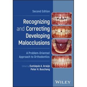 Recognizing and Correcting Developing Malocclusion s: A Problem-Oriented Approach to Orthodontics, Se cond Edition | Peter H Buschang (2025)