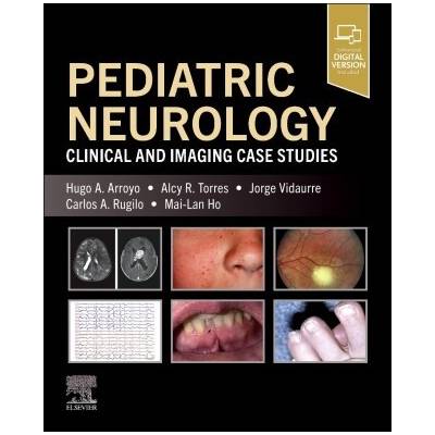 Pediatric Neurology