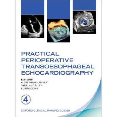 Practical Perioperative Transoesophageal Echocardiography | Sara Jane Allen, Surita Sidhu