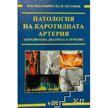 Image 1 of Патология на каротидната артерия