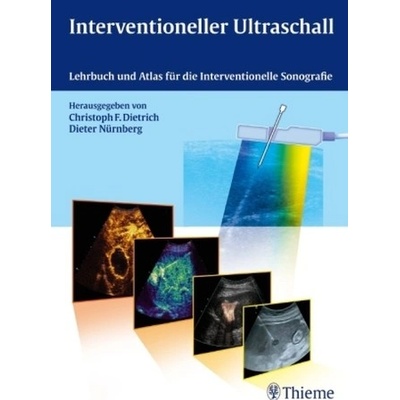 Interventioneller Ultraschall