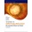 Training in Ophthalmology