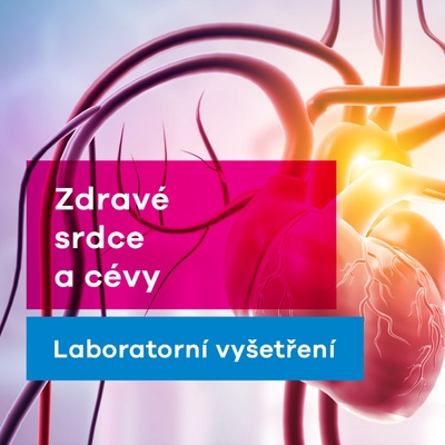 EUC Laboratoře test na zjištění rizika pro srdce a cévy
