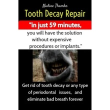 Tooth Decay Repair