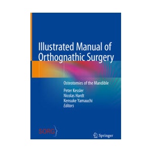 Illustrated Manual of Orthognathic Surgery | Peter Kessler, Nicolas P. Hardt, Kensuke Yamauchi (ISBN: 9783031069772)