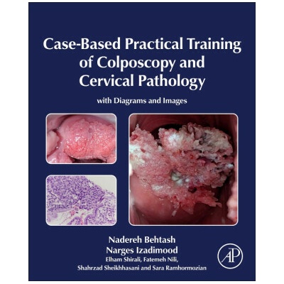Case-Based Practical Training of Colposcopy and Cervical Pathology (Nadereh Behtash,Narges Izadimood,Elham Shirali,Fatemeh Nili,Shahrzad Sheikhhasani,Sara Ramhormozian)(Pevná)