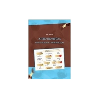 Aterotrombóza