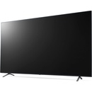 LG 75UN640S