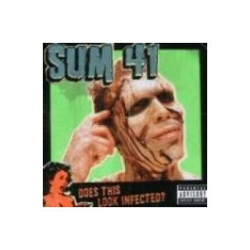Sum 41 - Does This Look Infected?