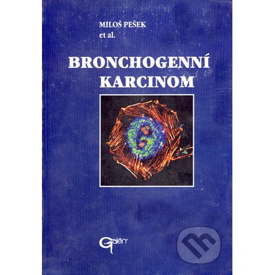 Bronchogenní karcinom - Miloš Pešek