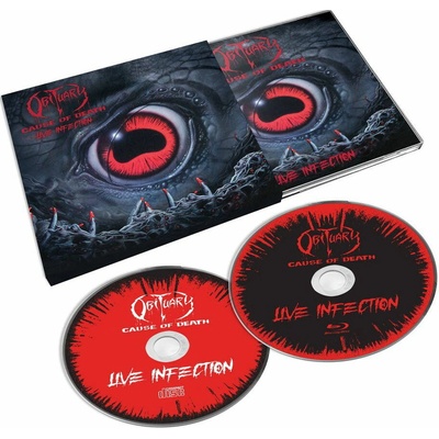 OBITUARY - CAUSE OF DEATH CD
