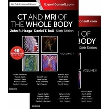 CT and MRI of the Whole Bod, 2 Volume Set - John R. Haaga, Daniel Boll
