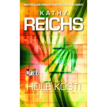 Holé kosti