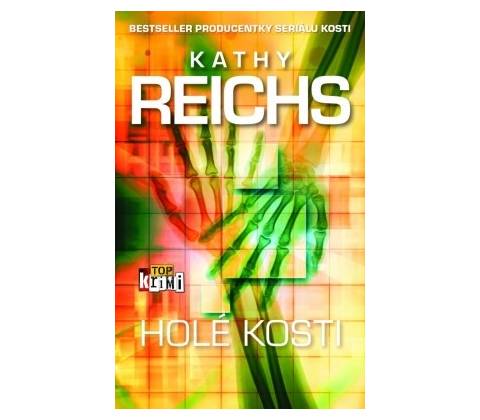 Holé kosti