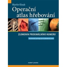 Operační atlas hřebování zlomenin proximálního femuru - Martin Kloub