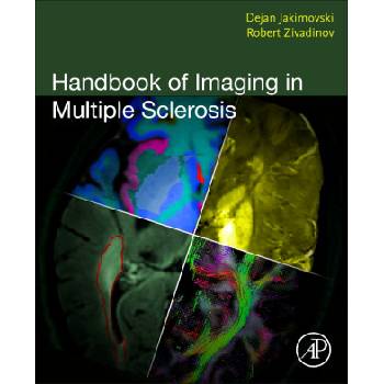 Handbook of Imaging in Multiple Sclerosis | Dejan Jakimovski, Robert Zivadinov