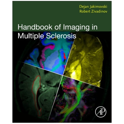 Handbook of Imaging in Multiple Sclerosis | Dejan Jakimovski, Robert Zivadinov