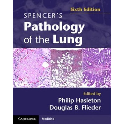 Spencer's Pathology of the Lung 2 Part Set with DVDs | Philip Hasleton