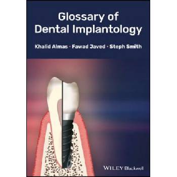 Glossary of Dental Implantology | Almas