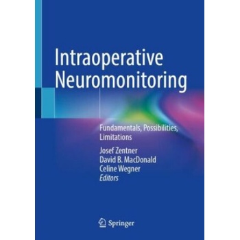 Intraoperative Neuromonitoring