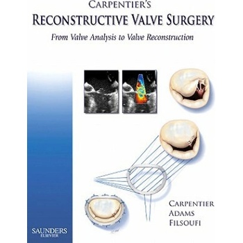 Carpentier's Reconstructive Valve Surgery