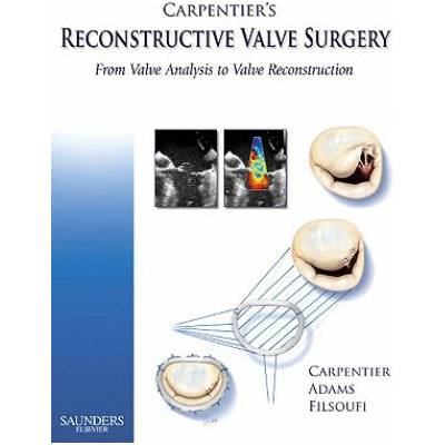 Carpentier's Reconstructive Valve Surgery