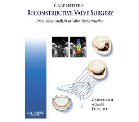 Carpentier's Reconstructive Valve Surgery