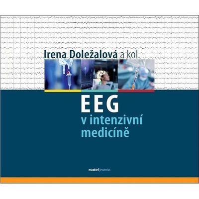 EEG v intenzivní medicíně - autorů kolektiv