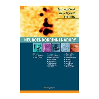 Neuroendokrinní nádory - Eva Sedláčková, Viera Bajčiová
