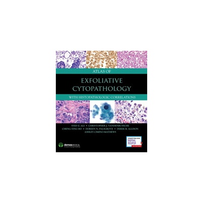 Atlas of Exfoliative Cytopathology: With Histopathologic Correlations Ali Syed Z.