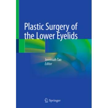 Plastic Surgery of the Lower Eyelids | University of California