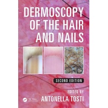 Dermoscopy of the Hair and Nails