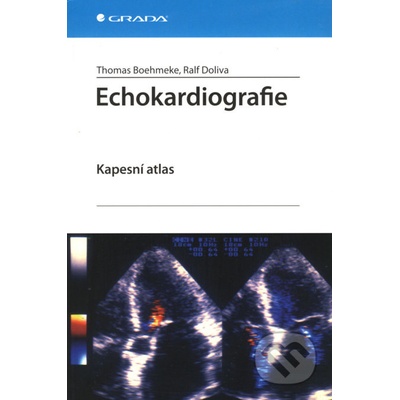 Echokardiografie - Thomas Boehmeke, Ralf Doliva