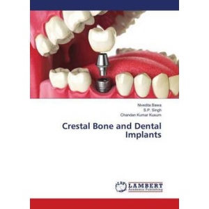 Crestal Bone and Dental Implants | Nivedita Bawa, S. P. Singh, Chandan Kumar Kusum (2018)