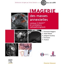 Imagerie des masses annexielles