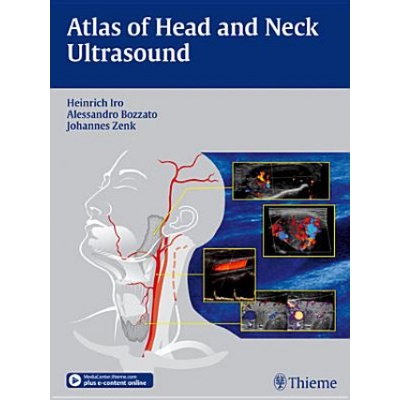 Atlas of Head and Neck Ultrasound Iro HeinrichPevná vazba