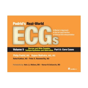 Podrid's Real-World ECGs | Philip Podrid, Rajeev Malhotra, Rahul Kakkar, Peter A. Noseworthy (ISBN: 9781935395058)